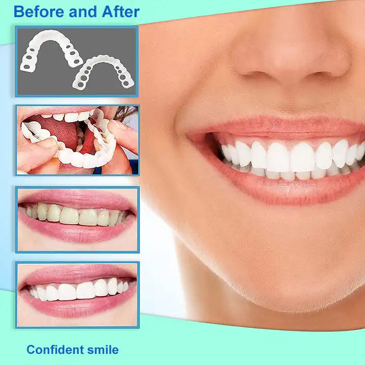 Artificial Teeth Cover Instant